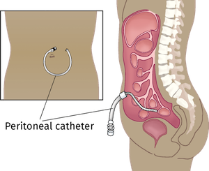 A diagram of a human body