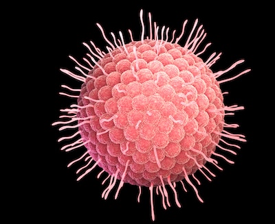 Varicella zoster virus