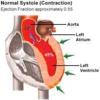 Normal Systole (Contraction)