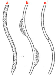 Improve Cannulation